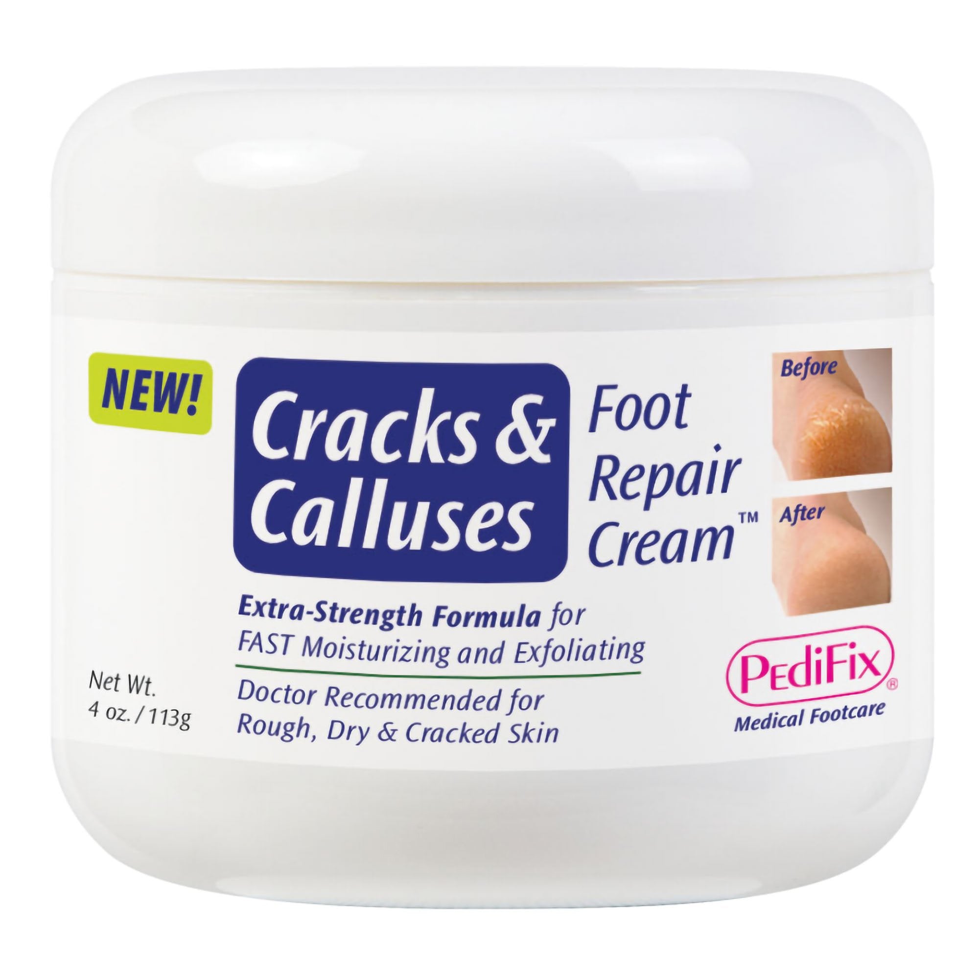 Foot Moisturizer PediFix® Cracks & Calluses 4 oz. Jar Scented Cream