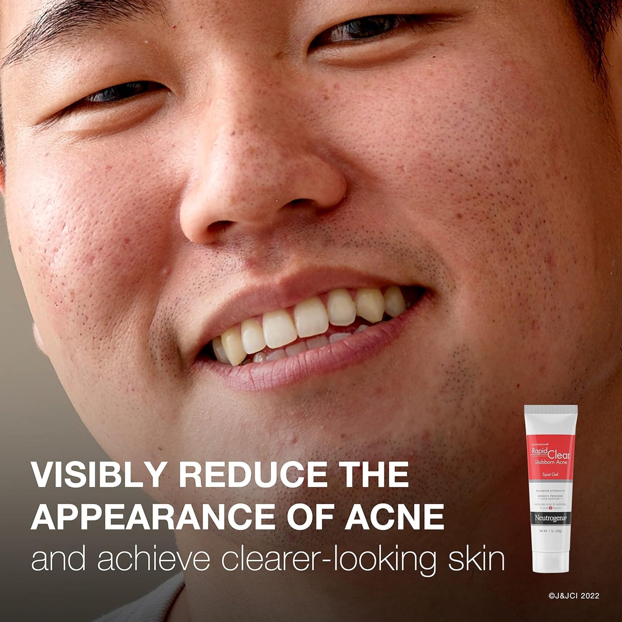 Acne Treatment Neutrogena® Rapid Clear 1 oz. Gel - image 6