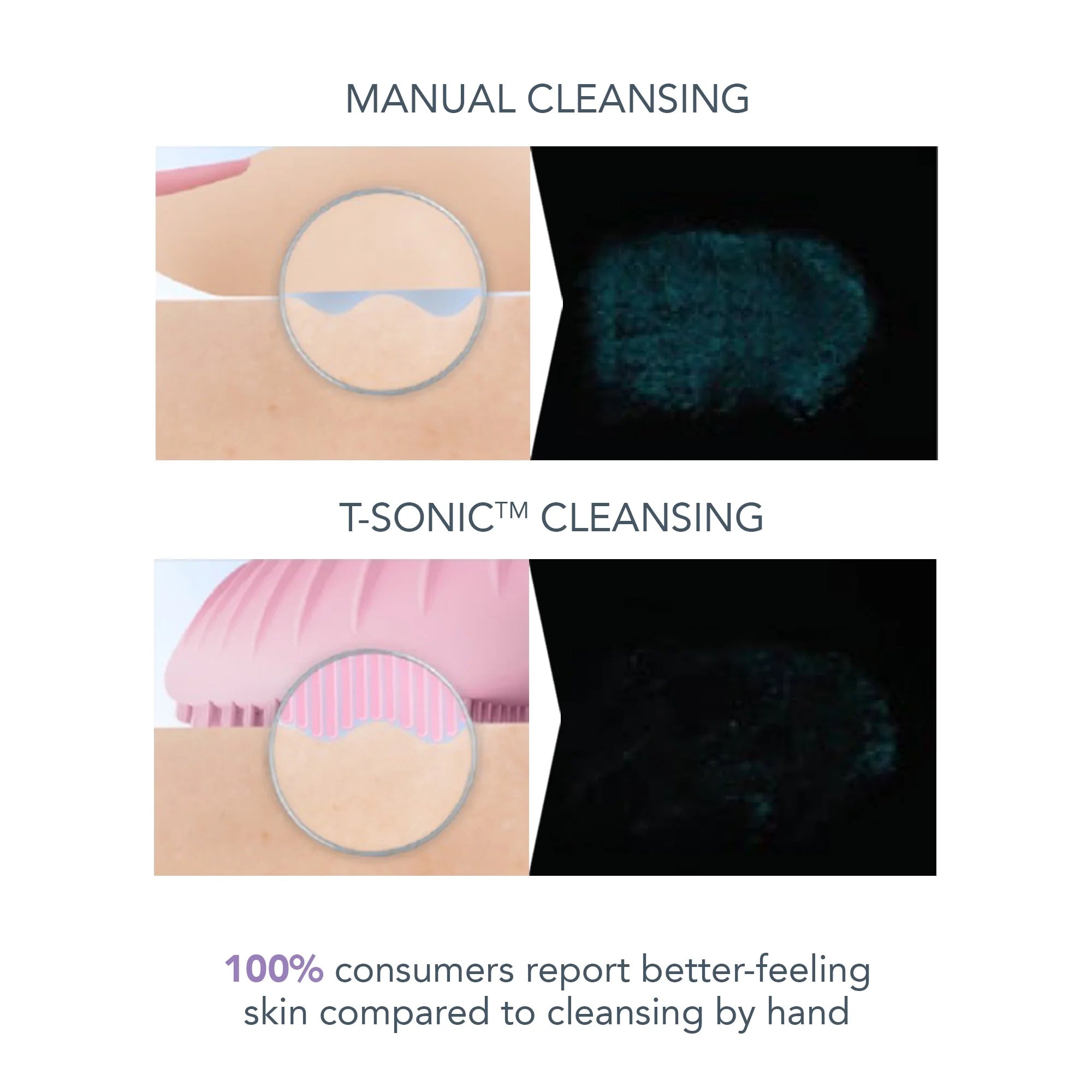 Foreo LUNA 3 Smart Sonic Facial Cleanser & Massager, for Sensitive Skin