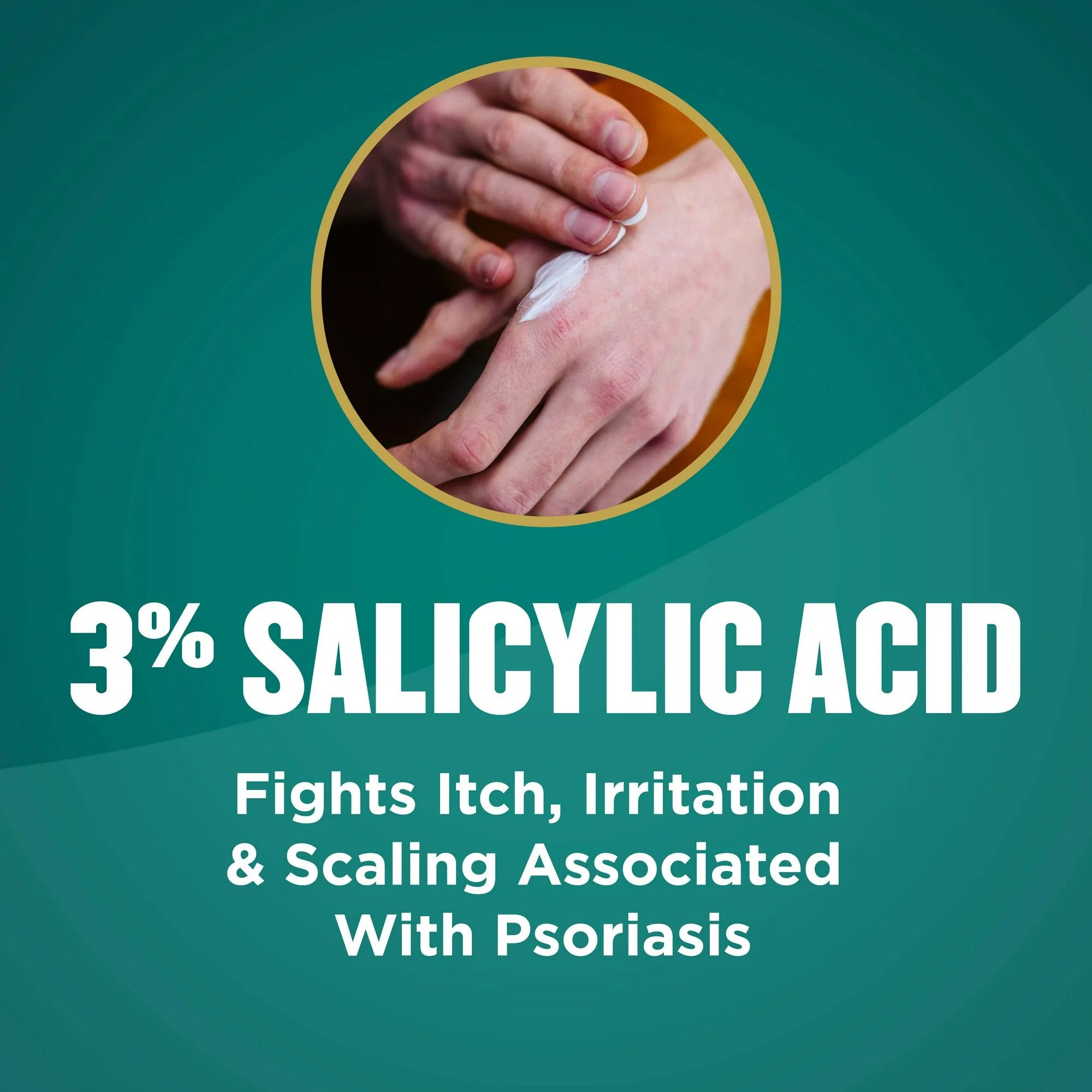 Psoriasis Cream Gold Bond® Psoriasis Relief Medicated Multi-Symptom 4 oz. Tube Unscented Cream (1 Unit)